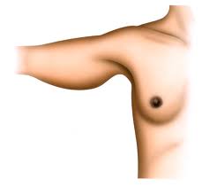 chirurgie des bras